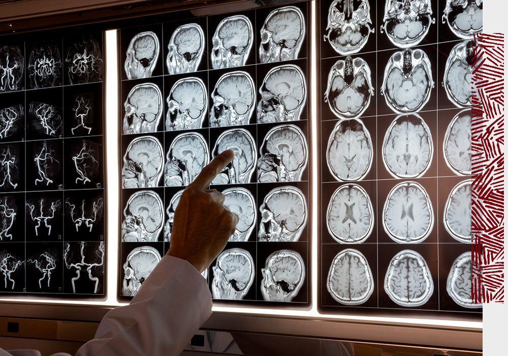 Multiple scans of brain images